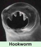 Hookworm parasite under the microscope ... (Click to enlarge)