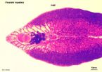 Fasciola Hepatica liver fluke worm parasite ... (Click to enlarge)