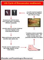 Guinea  worm, People infected with parasite ... (Click to enlarge)