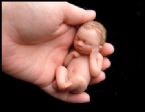 Amazing Miniature Babies by Camille Allen ... (Click to enlarge)